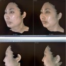 V라인경락마사지 | 노원역마사지 경락 얼굴 V라인 관리