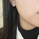 리엔뉴의원 티스토리