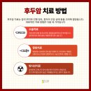 작은후두암 티스토리