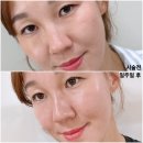 방배역 3번출구 옆 | 방배역피부과 포텐자 쥬베룩 효과 꿀조합 후기