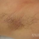 킴스헤어라인 이미지