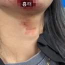 [전남] 주말, 공휴일 진료 가능한 병원/성형외과 전문/찢어진 흉터, 봉합
