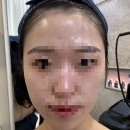 2호선 센텀시티역 4번출구 | [부산/센텀] 센텀피부관리 페이슬림 부산해운대점 알테온 관리 후기