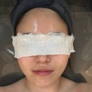 유성구청 5층 | 대전 봉명동 피부미인에서 물방울모공테라피로 모공 축소, 피부 진정 성공