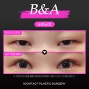 아이컨텍성형외과의원 이미지