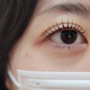 본스칼프 이미지
