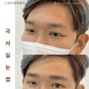 스칼프랩앤뷰티 속눈썹&눈썹&탈모 의정부점 이미지