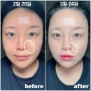 강력한 탄력관리를 홈케어로! 고주파마사지기 커런트바디 한 달 사용 후기