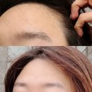 7-11주안행운점 | 주안역왁싱 인스슈가링왁싱 헤어라인(+구렛나루) 저통증 슈가링 후기