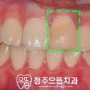 청주으뜸치과 이미지