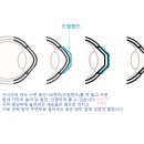 아이줌안경콘텍트 이미지