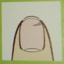 손톱모양