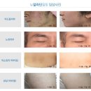 알라딘 스킨케어
