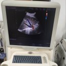 정산의료기 이미지