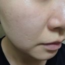 큐레스트 | 다이소신제품 버블케어로 피부에 숨을 불어넣는 큐레스트 후기
