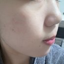 디에이치코 | 페슬로 딸기잼모공팩 후기｜10분 히팅팩으로 홈케어
