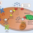 인산정형외과의원 | [의학] 운동하고 콜라색 소변, 횡문근 융해증의 증상과 합병증