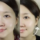 피부미용기기 뷰티디바이스 이노리프로 입가, 팔자 홈케어하기