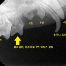 바비덴탈 이미지
