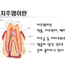 강서메트로치과의원 네이버블로그