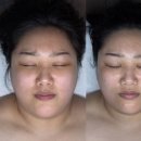 순환형2 | 나주피부관리 나주에스테틱 디바스킨 | 얼굴 비대칭, 속건조 개선 수분순환 2단계 후기💆🏻‍♀️