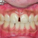 FIT치과기공소 이미지