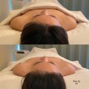 만덕1동-1 | 화명동 피부관리 직각어깨,데콜테 관리 ‘브이오미 에스테틱’