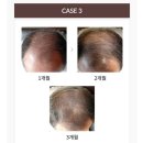 (주)바이오톡스텍 | 남자 명품 탈모예방샴푸 헤어토닉 세트 카론바이오 C3로 추천해줬지~