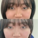 광희 농가 | 11월 둘째주~셋째주 엥겔지수 무한대