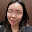 뉴스타의원 온다리프팅 솔직 후기💚