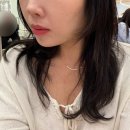 1회 사진기록전 | 울쎄라 스컬트라 효과 기록 강남 피부과 내돈내산 만족후기 (울쎄라 1주일차, 스컬트라 1회차)