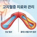 가슴튼튼내과의원 네이버블로그