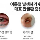 눈병 유행성 알레르기성 결막염 증상 및 원인 전염 치료 안약 이미지