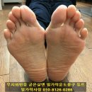 무너진 발란스를 바르게 잡아주는 발가락운동용구 이미지