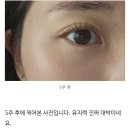 더 올림(The Ollim) | 일산 백석역 속눈썹 더올림, 노글루 수분영양펌 , 속눈썹 모발성장 주기