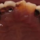 이랑치과기공소 이미지