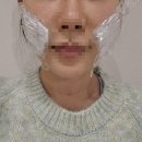 미희네 | 내돈내산 홍대 미희주사 후기(통증, 효과, 꿀팁 등)