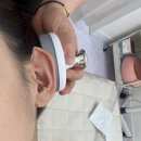 BYC빌딩 | 노원 피부관리 잘하는 곳 비츠로뷰티에서 CO2 카복시테라피 받은 후기