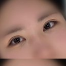 칠성메디칼 | 충북 제천 속눈썹 펌, 에스테틱 빛날 율