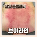 천안 에스테틱 용곡동 피부관리 어깨뒷목통증케어 브이라인 가마테라피 후기