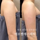할리스커피 대전가장점 | 대전 신부관리 추천 괴정동 에르벨에스테틱에서 팔관리 후기