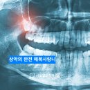 열린치과기공소 네이버블로그