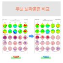 브레인한의원 이미지