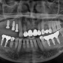 연세좋은치과기공소 이미지