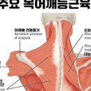 목 어깨 담 걸렸을때 담 걸리는 이유 담결림 이미지