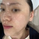 뷰티온의원 광주첨단 네이버블로그