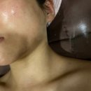 반포 윤곽관리 핫탄스파 반포점 후기 | 예비신부 피부관리, V라인 윤곽 관리 솔직 리뷰