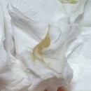 다모아한의원 | 질염 검사 테스트기 병원 안가고 3주만에 나았어요 (한의원, 산부인과)