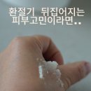 환절기 뒤집어진 피부 딥클렌징 해보세요