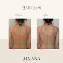 학사3길 1-1 | 도봉 고주파케어 하복부관리 부종관리 1:1 맞춤 힐바나 후기